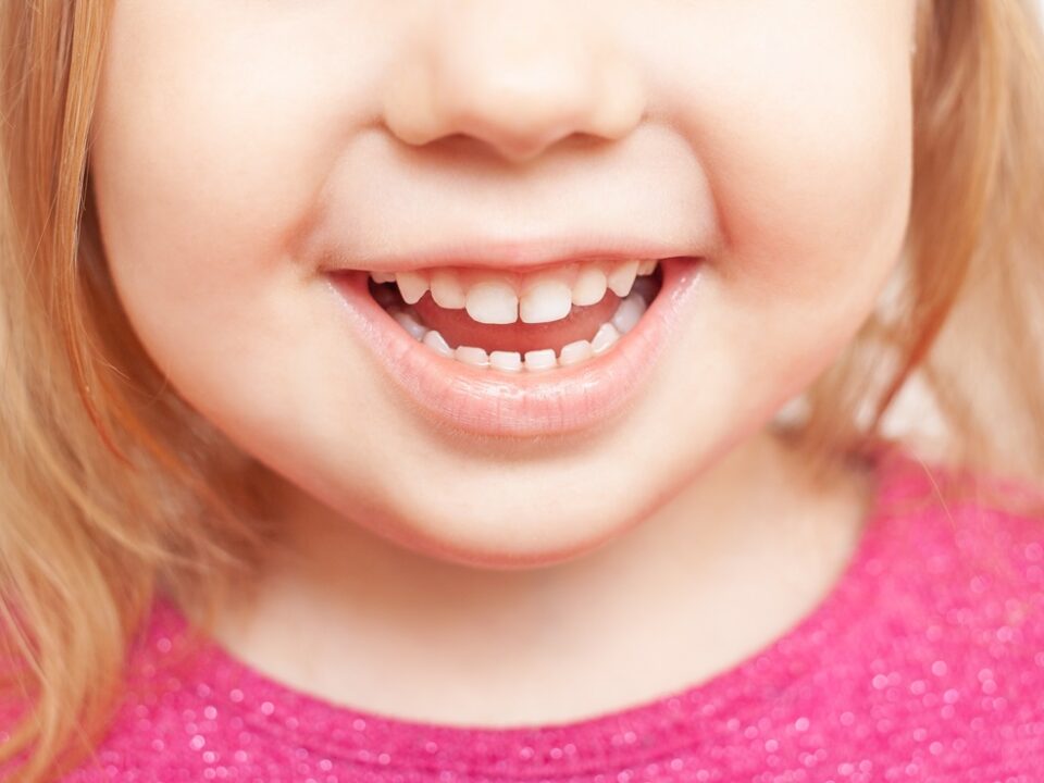 9 consigli per prenderti cura della salute dei denti di tuo figlio - bambina che sorride