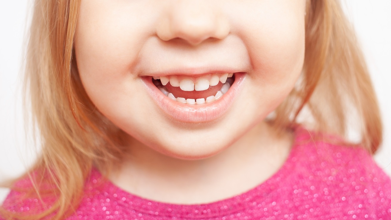 9 consigli per prenderti cura della salute dei denti di tuo figlio - bambina che sorride
