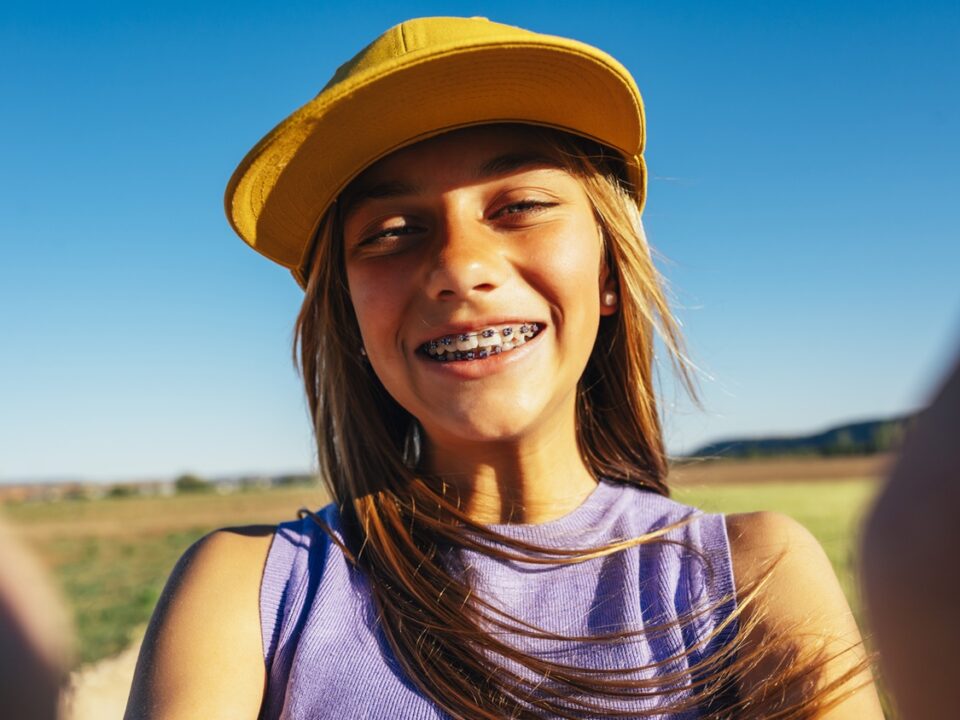 Apparecchio ortodontico per gli adolescenti quale scegliere